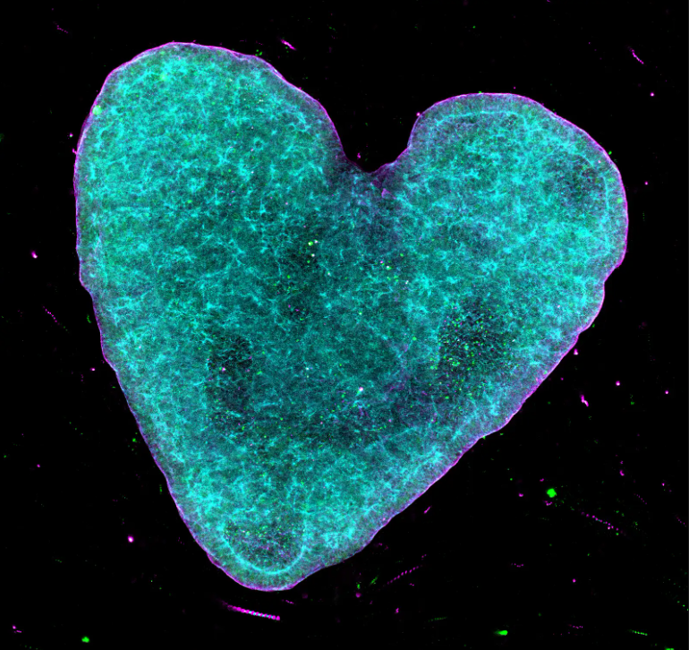 Heart Organoids