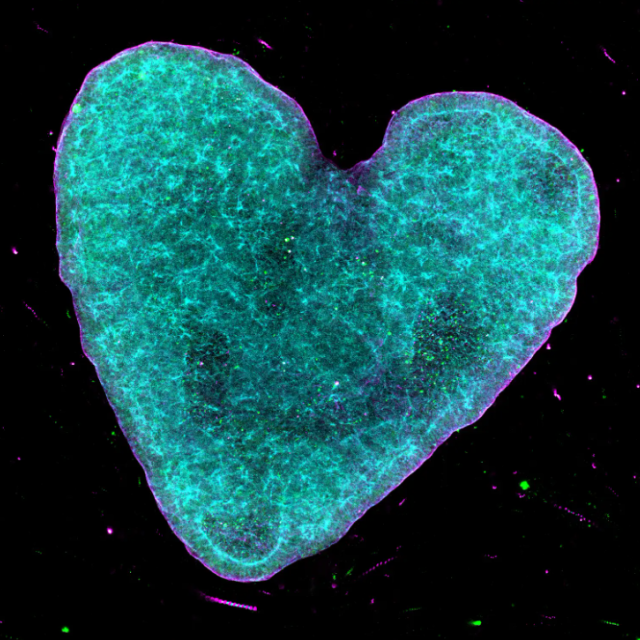 Heart Organoids
