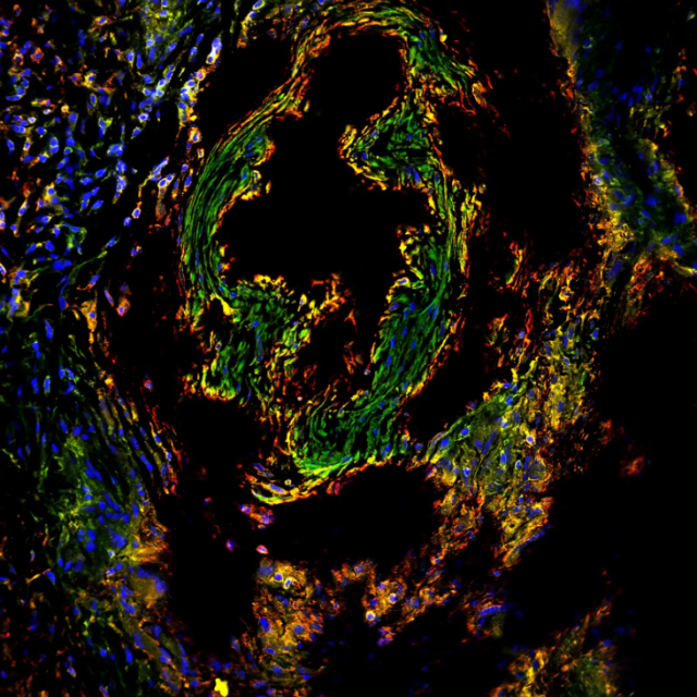 Cardiac Rainbow