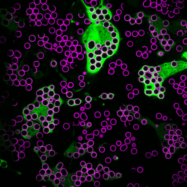 Hungry Hungry Macrophages